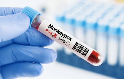 ​美国 CDC：纽约等大城市新增病例下降 猴痘疫情有望放缓