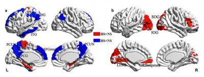​这 4 件事，正在“杀死”你的大脑！可能每天都在做！
