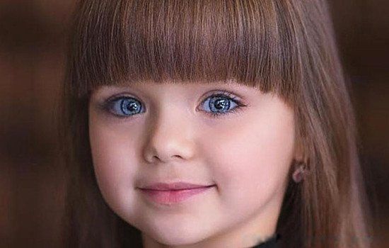 歌舞伎综合症患者图片 是什么病成年后真的漂亮吗