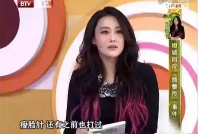 哪些明星打过瘦脸针(哪些女明星打瘦脸针了) 明星 女明星 第4张