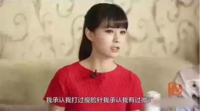 哪些明星打过瘦脸针(哪些女明星打瘦脸针了) 明星 女明星 第3张