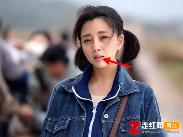 殷桃的嘴唇是怎么回事