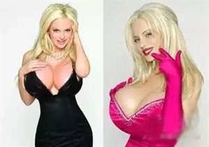 世界胸部最大女人图片 已经严重影响审美观