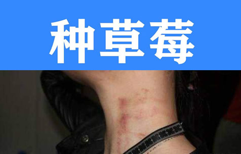 草莓吻痕图片大全 草莓印怎么快速消除掉