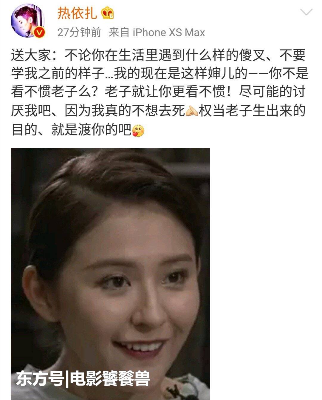 热依扎自曝患重度抑郁症什么时候得的 热依扎为什么得抑郁症原因