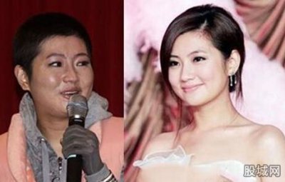 ​selina任家萱烧伤图片现场曝光任家萱为什么恨俞灏明真实原因揭秘