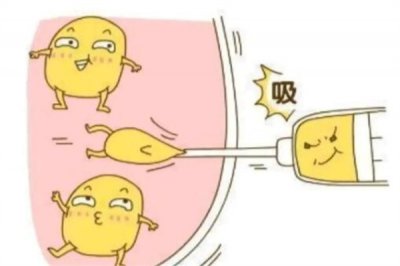 ​抽脂肪20斤一般多少钱?1000元到3000元之间(按身体部位)