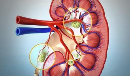 大量饮用碳酸饮料的六大危害 常喝碳酸饮料有哪些危害