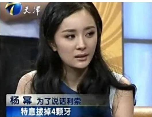 业内人士点评杨幂整容（杨幂整容动了下颚角）