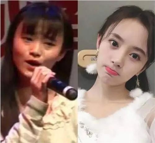 鞠婧祎整容前(四千年美女鞠婧祎整容前后差别)