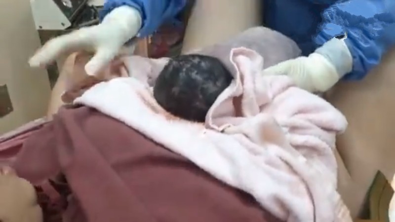 女人生孩子图片（组图带你看产妇顺产全过程）