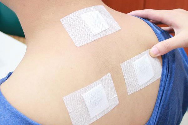 三伏贴贴敷部位图 一般都是贴在脖子后面