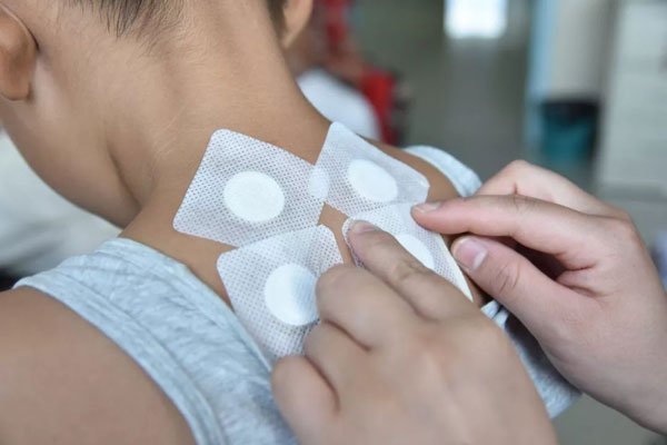 三伏贴贴敷部位图 一般都是贴在脖子后面