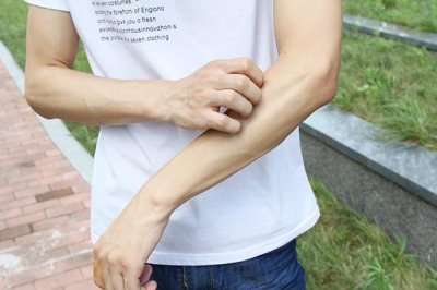 螨虫叮咬后的症状图（人被螨虫咬了会怎样）