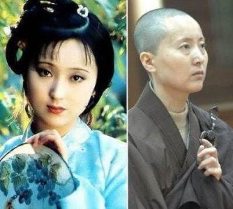 ​陈晓旭得了什么(陈晓旭化疗了吗)