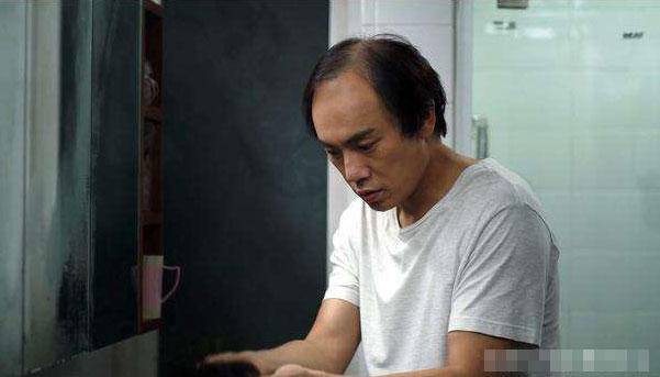 梦到自己秃顶了是什么征兆（解梦之梦见自己秃顶的含义）