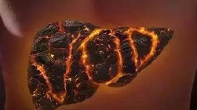 ​肝脏排毒会长痘吗(肝脏不好会长痘痘吗)