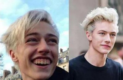 ​油性皮肤如何美白最快(油性皮肤美白小窍门)