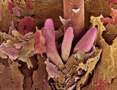 ​如何判断头上是否有螨虫(怎么判断头发里有螨虫)