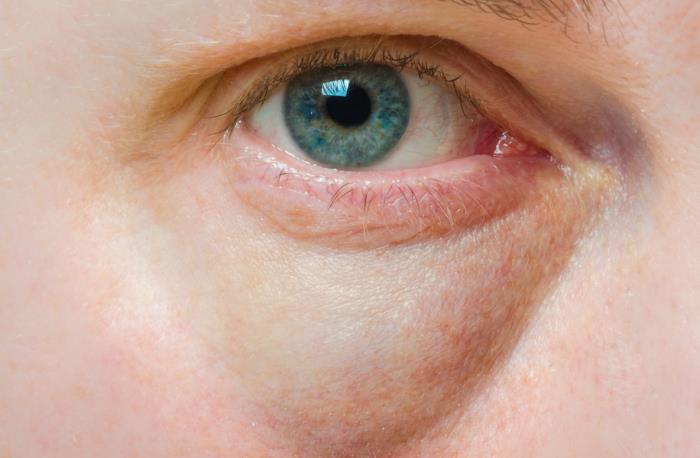 为什么能或不能这样(告诉你为什么不能揉眼)