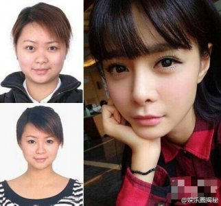 ​女明星整容前后，明星整形前后对比照图片
