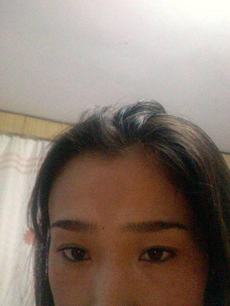 印堂发黑的真实图片,印堂发黑是什么征兆如何破解？本文共（963字）