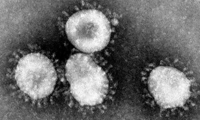 ​病毒存在多少亿年了（病毒在地球上有40亿年历史了）