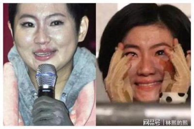 ​she烧伤，selina俞灏明烧(selina烧伤事件之后为什么从提起俞灏明)