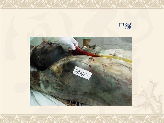 尸绿是什么意思（尸绿什么时候出现）