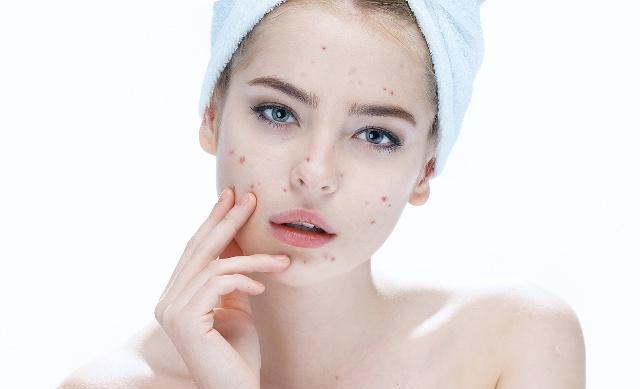 如何正确卸妆的方法步骤(卸妆比化妆更重要)(2)