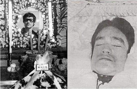 李小龙的死亡真实原因（来看看李小龙到底是怎么死的）(3)