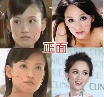 陈乔恩颜值变化（陈乔恩十年整容路）(5)