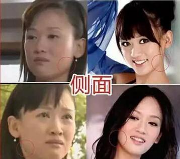 陈乔恩颜值变化（陈乔恩十年整容路）(6)