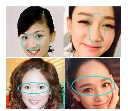 陈乔恩颜值变化（陈乔恩十年整容路）(9)