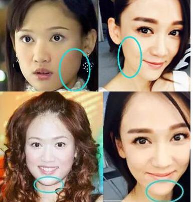 陈乔恩颜值变化（陈乔恩十年整容路）(10)