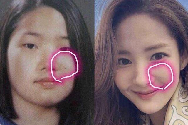 金喜善整过容吗（整容后遗症有多可怕）(3)