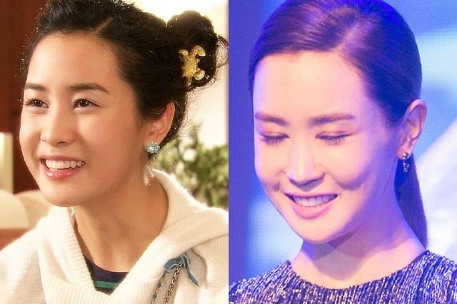 金喜善整过容吗（整容后遗症有多可怕）(9)