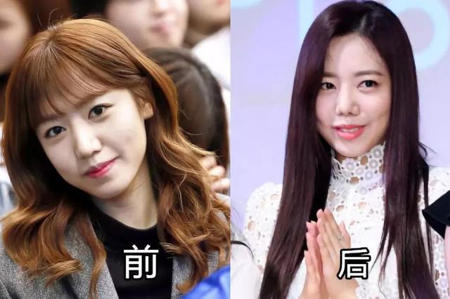 金喜善整过容吗（整容后遗症有多可怕）(12)