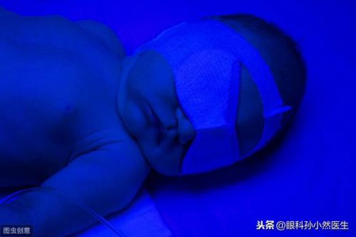 蓝光治疗新生儿黄疸的副作用(蓝光治疗新生儿黄疸的效果ppt)-第2张图片-