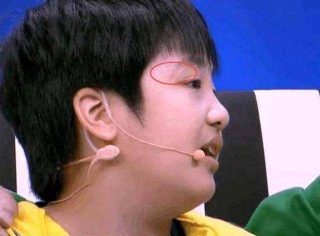 吴镇宇儿子受伤后续（近年来综艺事故及涉及艺人）(16)