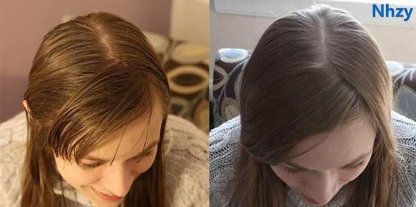 如果长期不使用洗发水头发会有什么后果吗