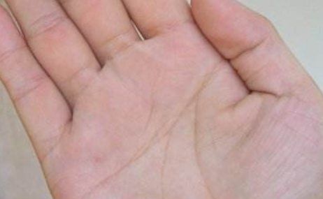 断掌是什么意思,人们说的断掌是什么意思图3