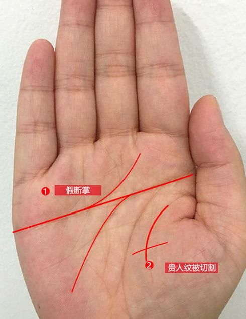 断掌是什么意思：断掌纹是啥意思 