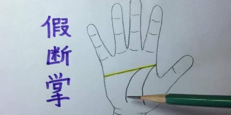 断掌是什么意思：什么是断掌