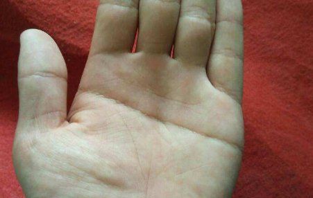 断掌是什么意思,人们说的断掌是什么意思图5