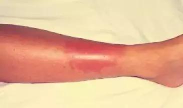 河北暴雨最新消息今天降雨量 河北主汛期来了(10)