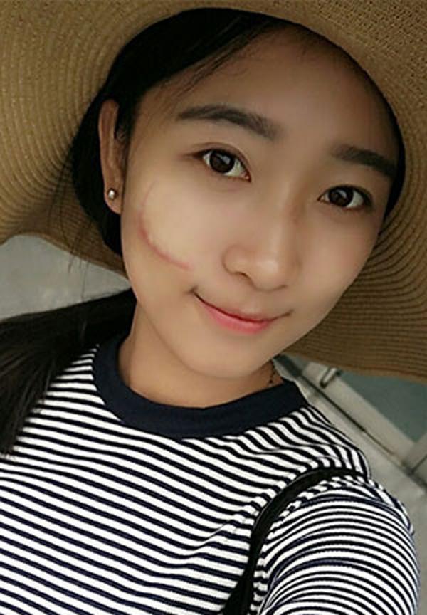 美白祛疤痕最快的方法（拥有完美无瑕的肌肤想必是各个爱美MM的梦想）(1)