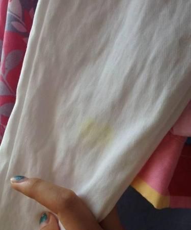 衣服变黄了有什么方法能洗掉