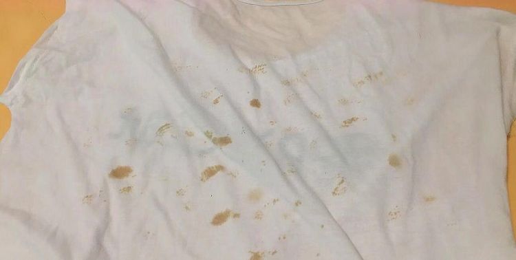 白衣服发黄怎么洗得白