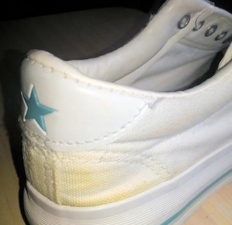 网面鞋子发黄了用什么方法可以变白羊金皮